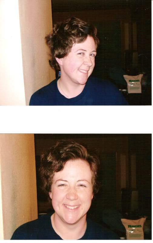 Pictureofbadchemohair.jpg really bad chemo hair picture by thebandteacher