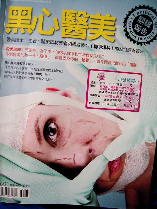 【分享】玻尿酸趕走苦情淚溝,尚安診所玻尿酸體驗記!